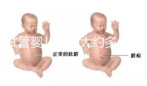 試管嬰兒費(fèi)用大約多少2021年：國內(nèi)試管之（10）額外可能需要費(fèi)用：