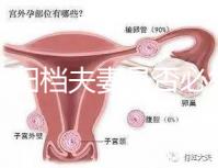 試管歸檔夫妻是否必須登記，一個號碼可以看到這篇文章就足夠了