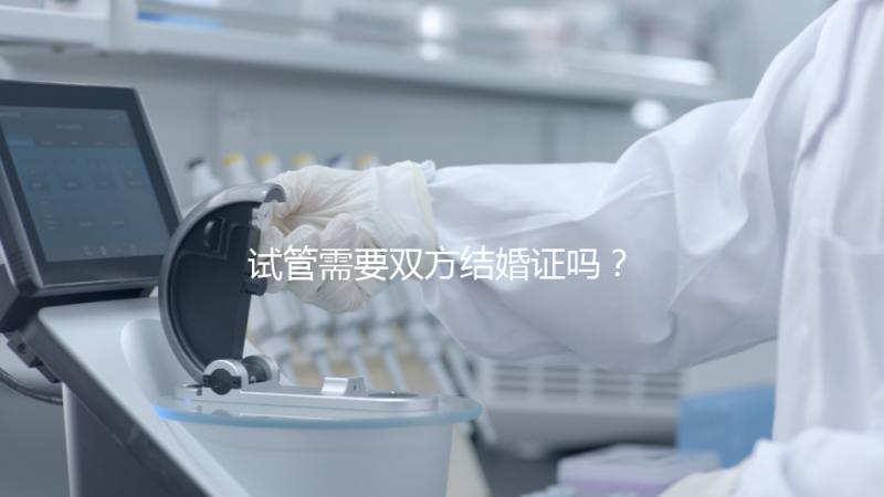 試管需要雙方結婚證嗎？試管是不是需要結婚證