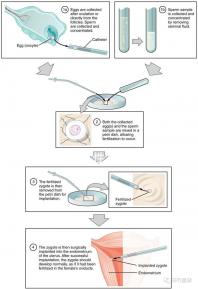 貴陽(yáng)單身女性禁止凍卵？持“三證”已婚女性就能凍卵
