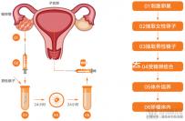 赴美考察歸來!HRC醫(yī)院的6位試管嬰兒醫(yī)生是亮點