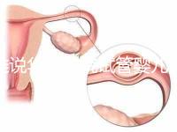 誰說華西二院試管嬰兒成功率不高，那是你沒選對生殖醫(yī)生
