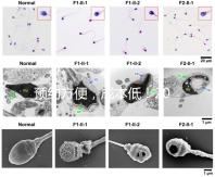 預約方便,成本低!2024年西安新城、臨潼、雁塔四維彩超指南