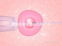 高齡能做試管嬰兒嗎？不是想做就能做得滿足這5個條件