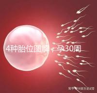 4種胎位圖解，孕30周這個姿勢最適合順產(chǎn)