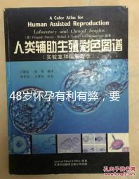 48歲懷孕有利有弊，要不要生需考慮這3點！