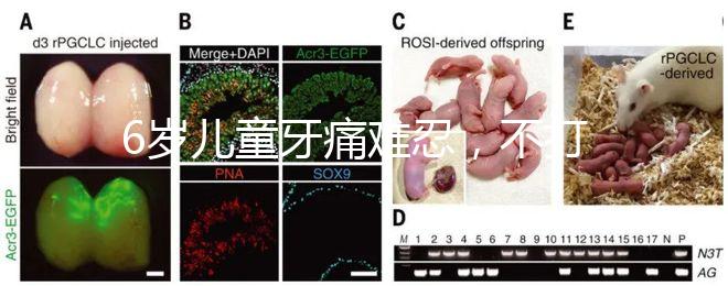 6歲兒童牙痛難忍，不打針吃藥5個小妙招快速止疼