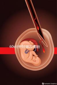 60s分析妊娠22周胎教哪些內容比較好,觸摸、光照都有好處