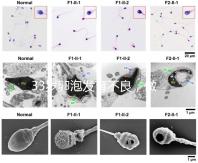 33歲卵泡發(fā)育不良，做試管黃體期促排方案失敗怎么辦？