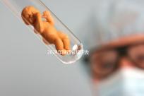 2024年陜西省規(guī)定發(fā)放獨生子女費,包括咸陽市補貼標準和領(lǐng)取流程