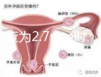 nt檢查為2.7mm時危險性莫亂猜，做完無創后才能確定